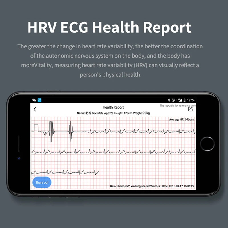 Greentiger G36 Smart Armbånd EKG-PPG Vandtæt puls, Blodtryk Smart Armbånd Fitness Tracker Ring Påmindelse VS G26