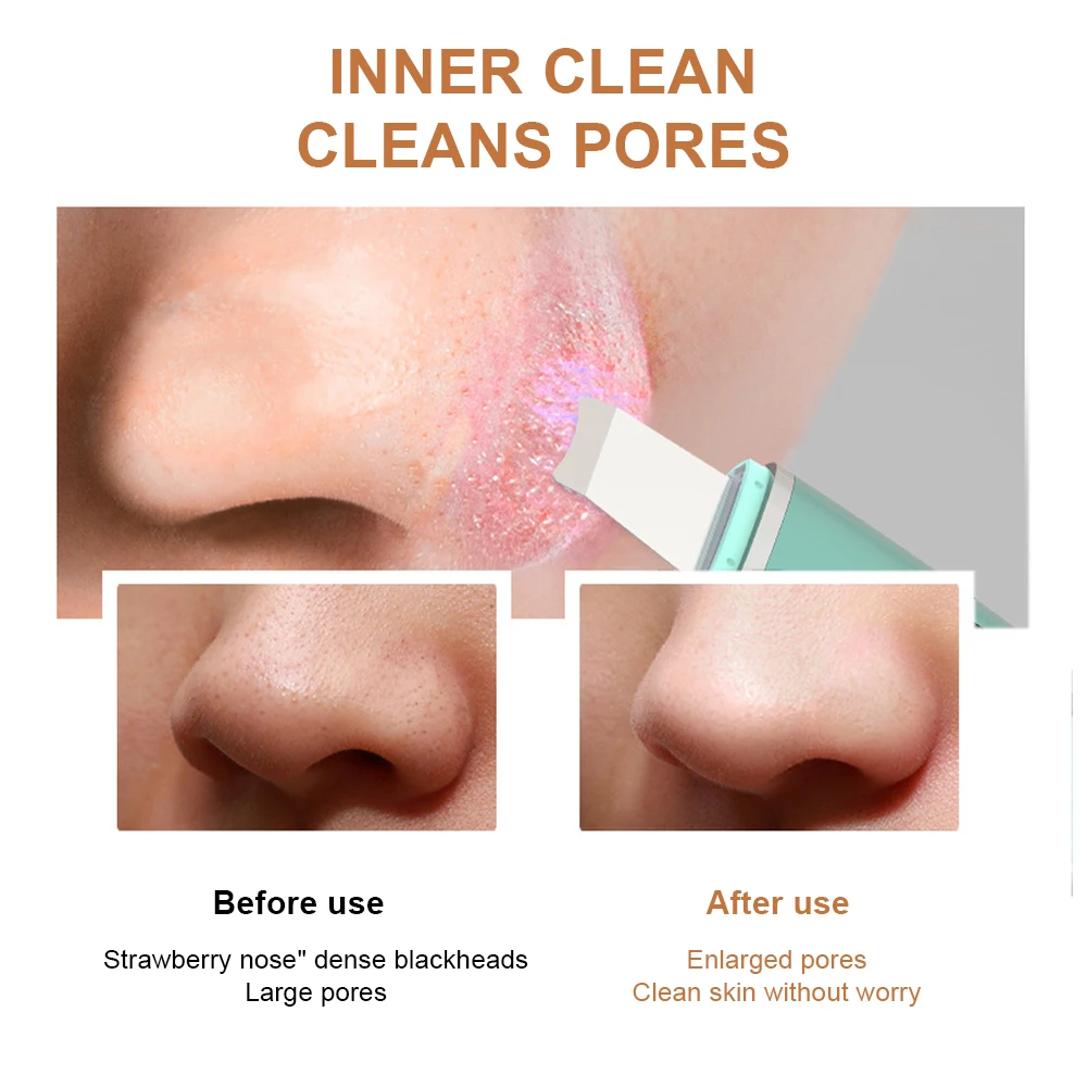Msmask Ultralyd Skrubber Huden Dybt Ansigt Rengøring Maskine Peeling Skovl Facial Pore Renere Ansigt Hud Skrubber Lift Maskine
